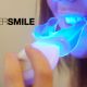 Whiter Smile Review | Effective and Tasty Teeth Whitening Kits For All