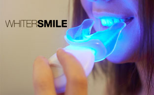 Whiter Smile Review | Effective and Tasty Teeth Whitening Kits For All